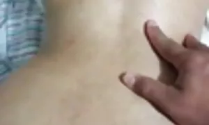 in anal prolapse uma ...