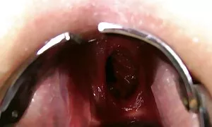 dabl anal fisting, p ...