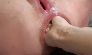 ass anal mɛksiko slu ...